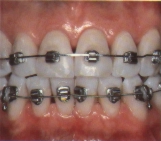ortho8.jpg