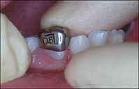 Crown1.jpg