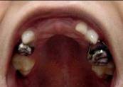 crown-and-loop-1.jpg